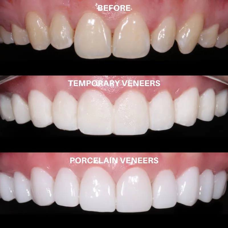 a collage of teeth before and after