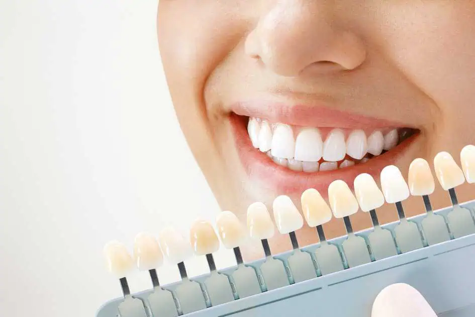 " Teeth Whitening in Oceanside, CA by California Coast Dental Arts