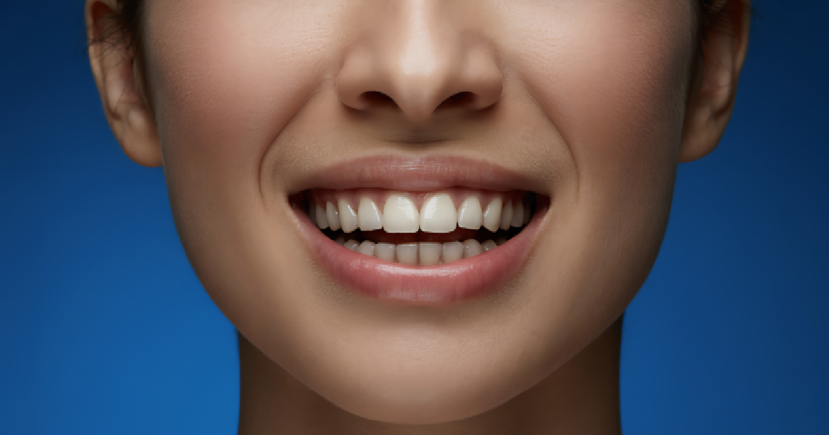 Close-up of a smiling person showing teeth after full mouth reconstruction in Oceanside, CA
