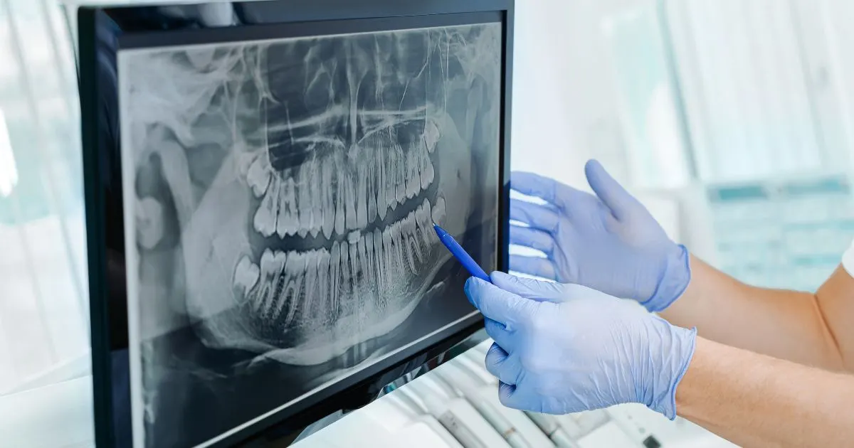 Dentist reviewing a Digital dental X-ray of teeth and jawbone on a computer screen for accurate dental imaging diagnostics.