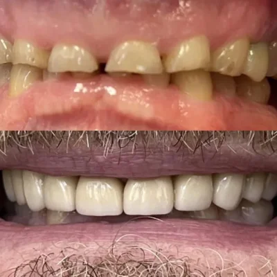 a collage of teeth and mouth