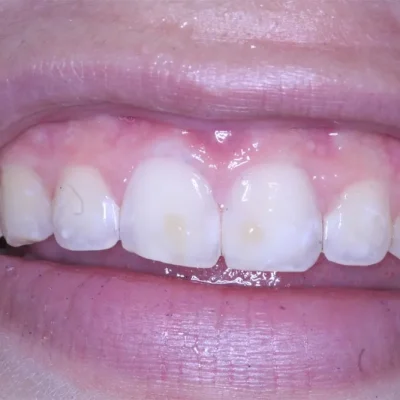 close up of a person's mouth