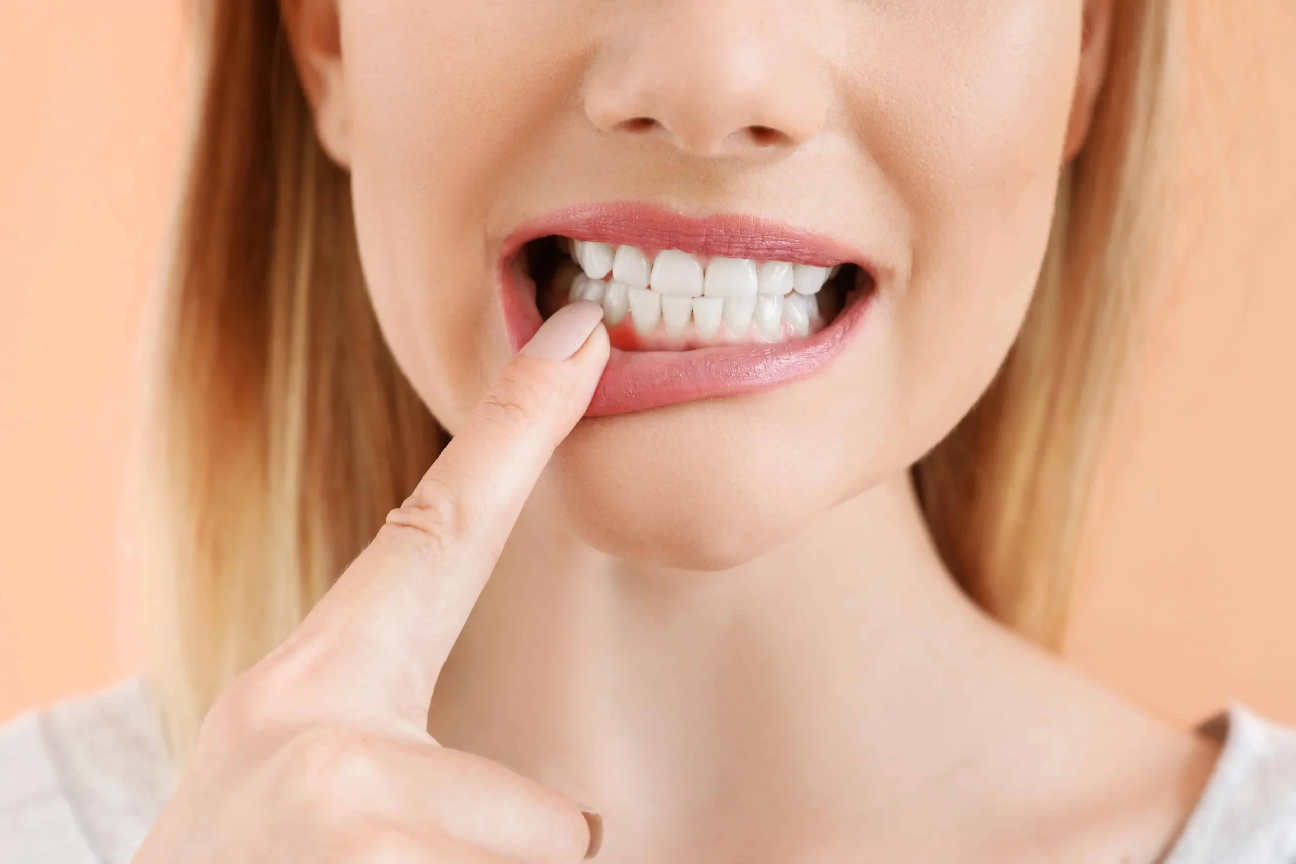 a woman with her finger in her mouth | Composite Tooth Colored Fillings in Oceanside, CA