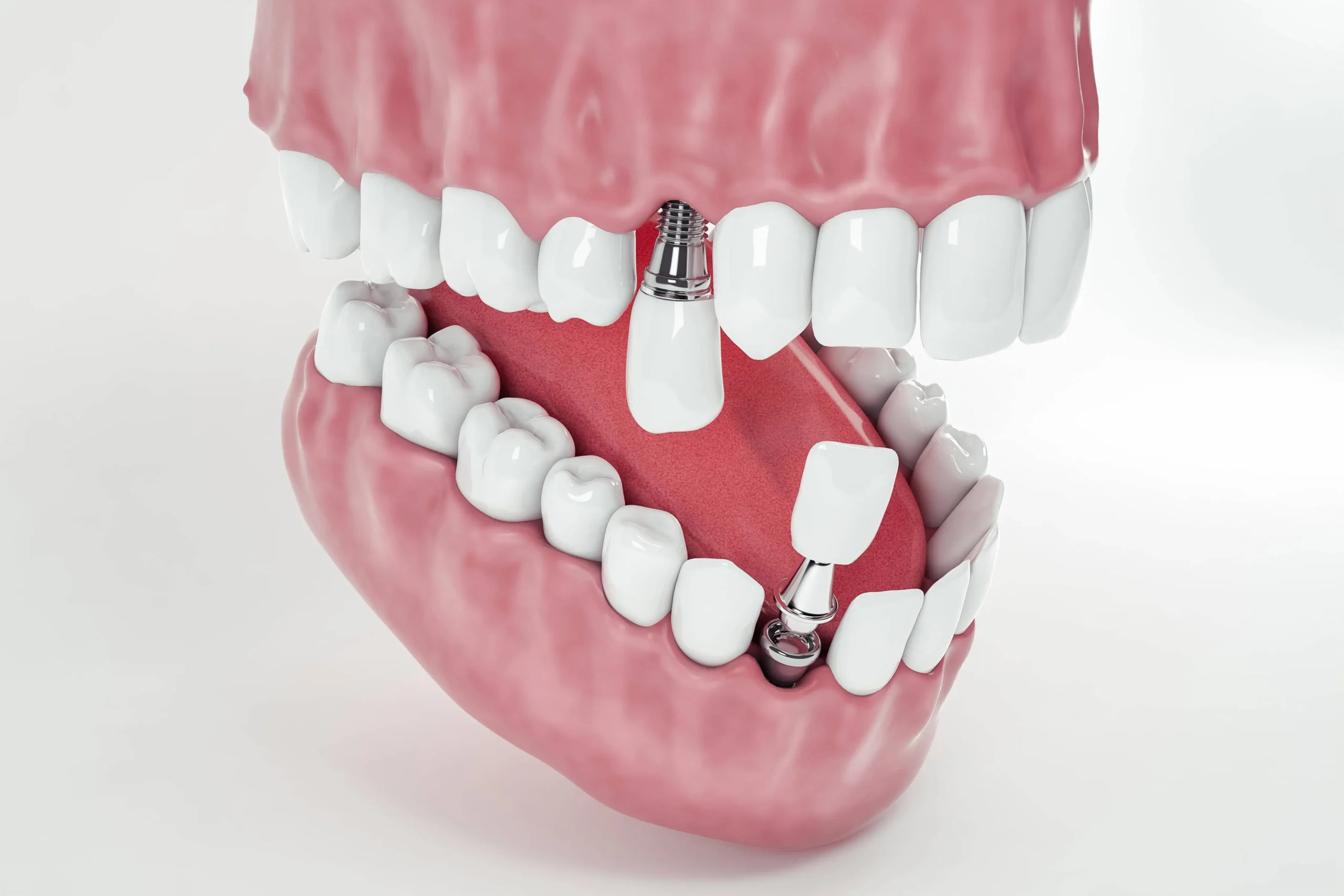 a model of a human mouth with teeth and dental tools